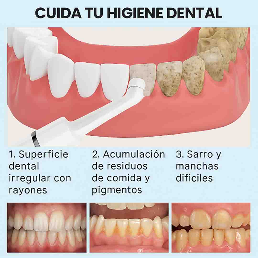 Combo Quita Manchas: Pulidor Dental + Obsequio Blanqueador