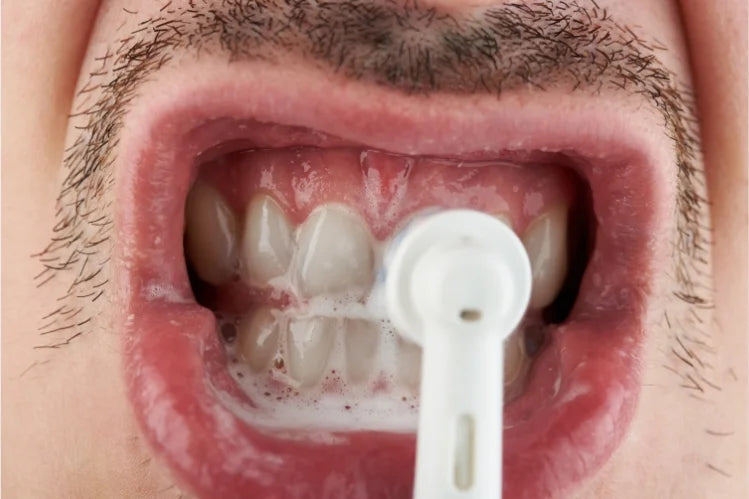 Combo Quita Manchas: Pulidor Dental + Obsequio Blanqueador