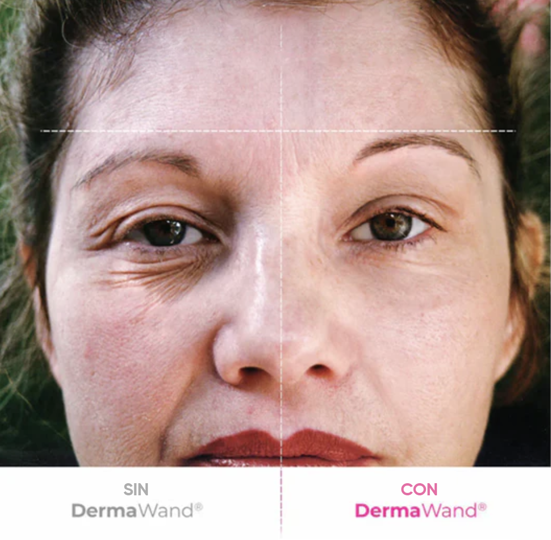 DermaWand, Tecnología para una piel firme y radiante en casa