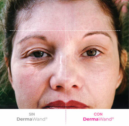 DermaWand, Tecnología para una piel firme y radiante en casa